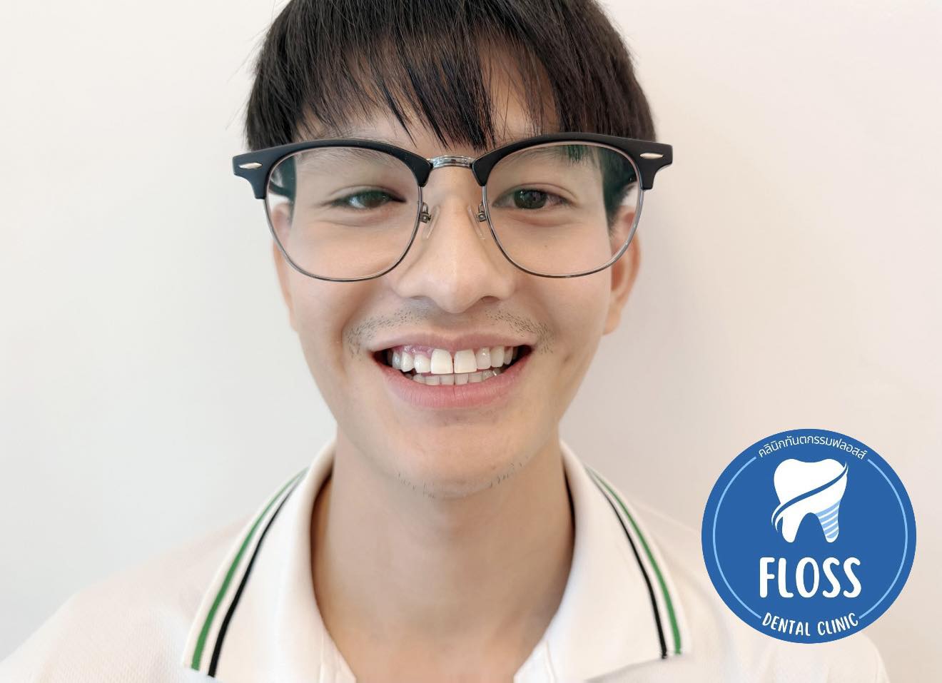 teeth whitening, whitening, cosmetic dentist, dental clinic, huahin dentist, recommended dentist, floss dentil clinic